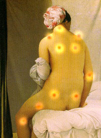 pacientes con fibromialgia benefician mucho de tratamientos de quiropractica