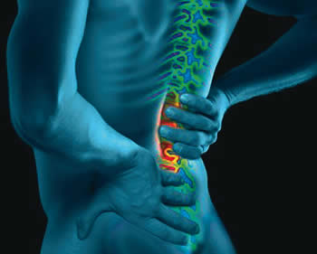 Como se puede aleviar el dolor de una hernia de disco